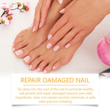 Hand And Foot Nail Fungus Cleansing Repairing, Softening Brightening Nutrient Care Solution