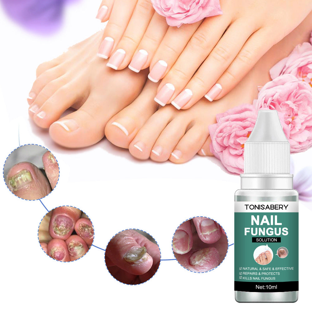 Nail Fungus Repairing Nourishing