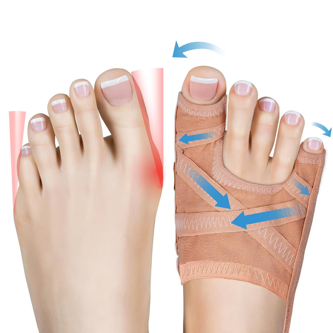 Adjustable Bunion Corrector Toe Separator